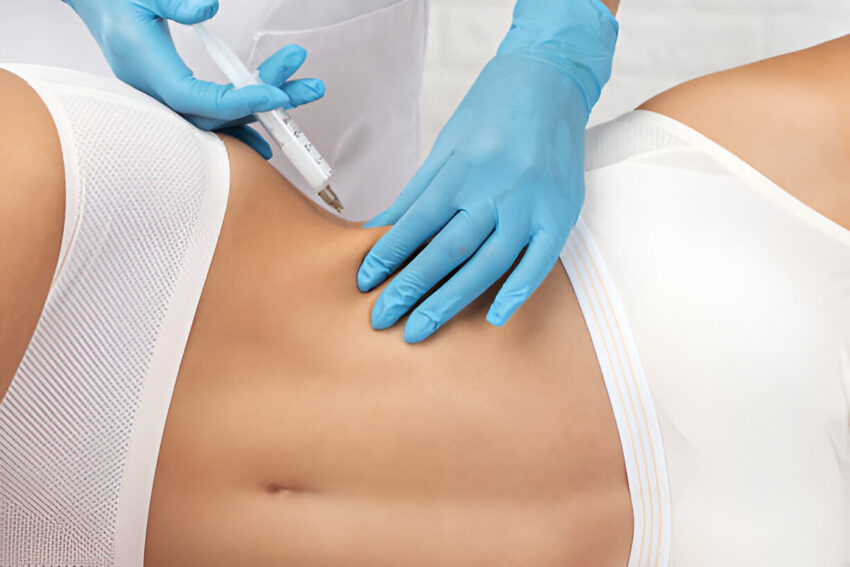 Refresh Your Body Profile with Body Fillers