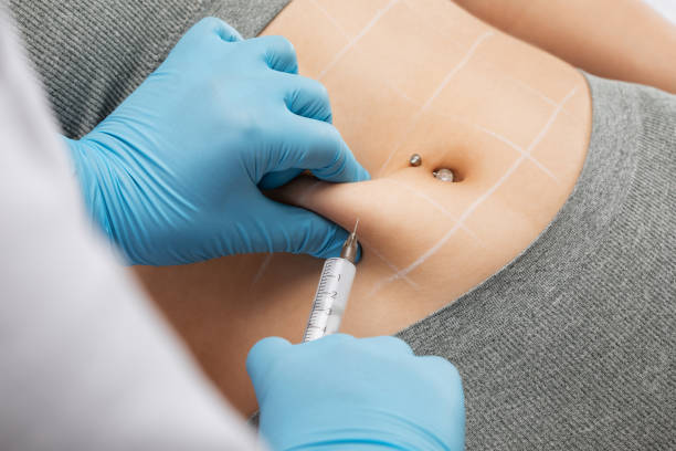 What makes Fat Dissolving Injections a popular choice