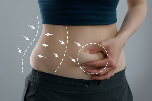 How can Tummy Tuck help reshape the lower abdominal area