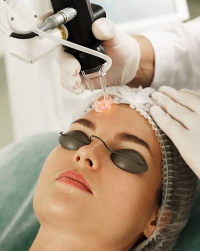Is Pico laser treatment suitable for sensitive skin