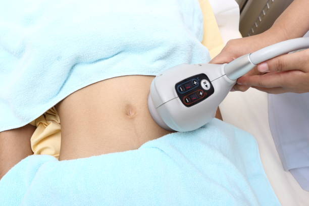 What should you know before considering Non surgical Fat Reduction