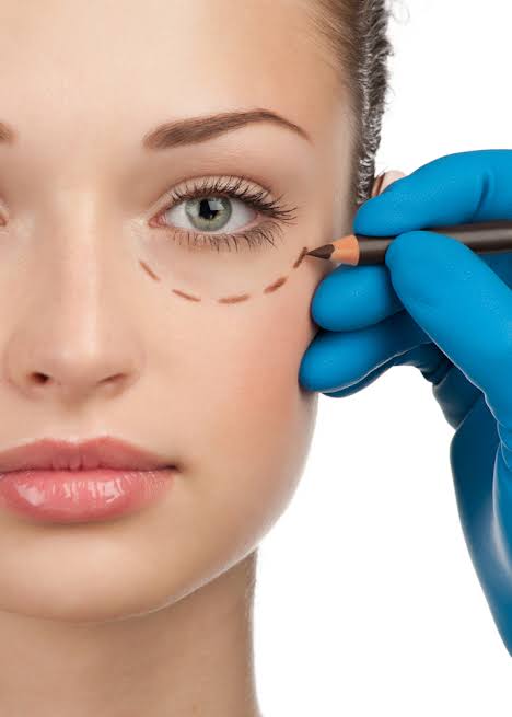 What factors determine suitability for Eyelid Surgery