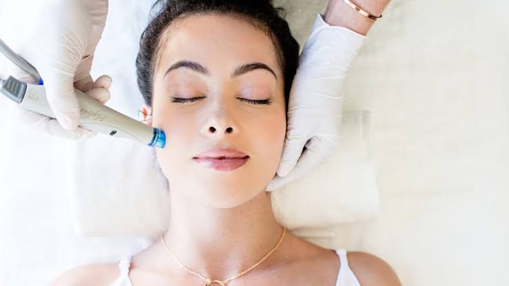 Does Melasma Treatment help achieve a more balanced skin tone