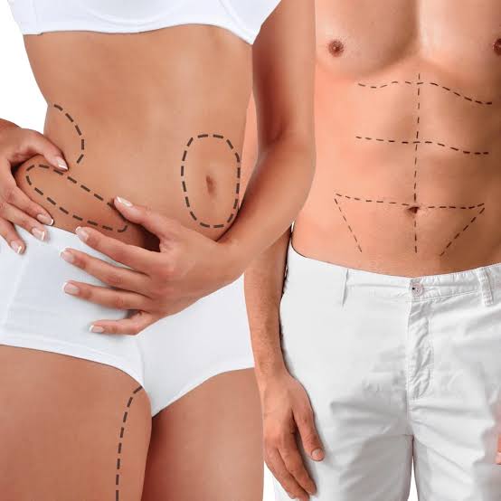 Liposuction 1024