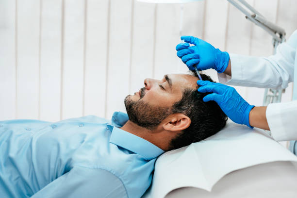 Does FUE Hair Transplant improve hair density and coverage