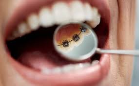 Center City Orthodontist